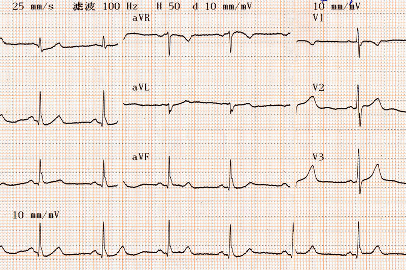 ECG ONLINE is an easy-to-use learning platform and information resource that helps medical students and clinicians to practise interpreting electrocardiograms.