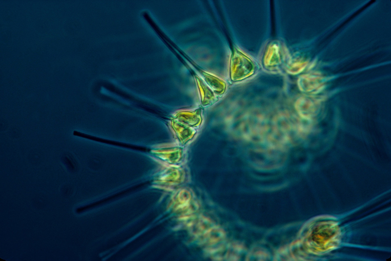 Phytoplankton – microscopic organisms that live in water – vary in size and shape. Like land plants, they can photosynthesize and turn sunlight into energy, placing them at the base of aquatic food webs.
