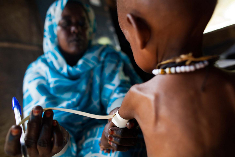 Severely malnourished children are at high risk of contracting malaria and dying from it as they are unable to absorb antimalarial drugs effectively.