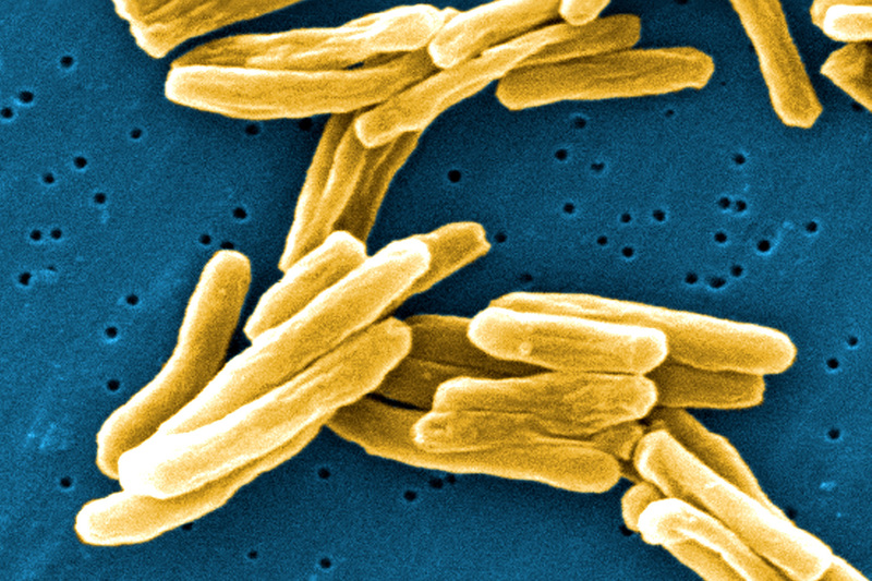 Mycobacterium tuberculosis – the bacterium that causes tuberculosis – under the microscope. UCT has been awarded seed funding by Imperial College London and MIT to better understand how the disease spreads.