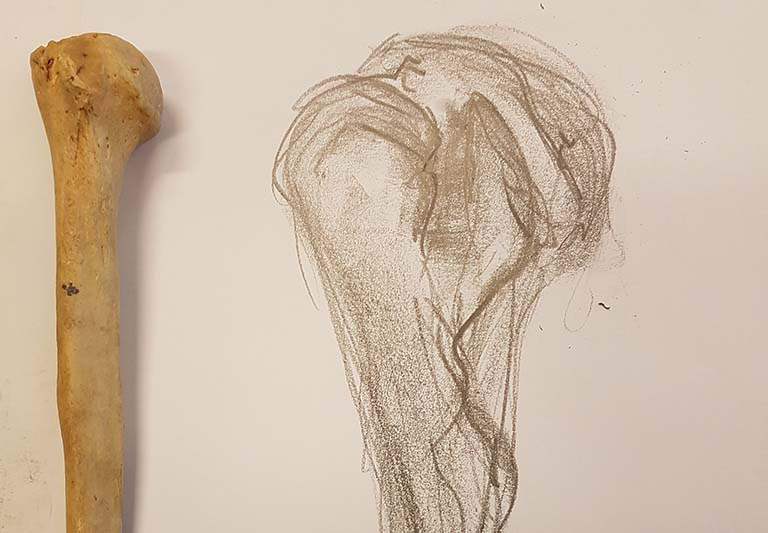 An observation of the head and neck of the humerus.