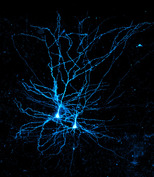 A blue-stained human pyramidal neuron, a type of large neuron named for its triangular cell body.