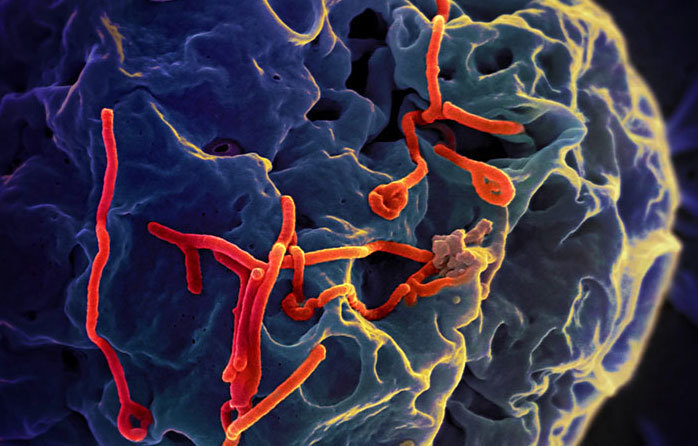 Scanning electron micrograph of Ebola virus budding from the surface of a Vero cell (African green monkey kidney epithelial cell line). 