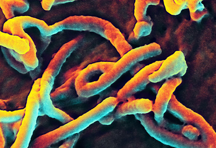 Scanning electron micrograph of Ebola virus budding from the surface of a Vero cell (African green monkey kidney epithelial cell line).