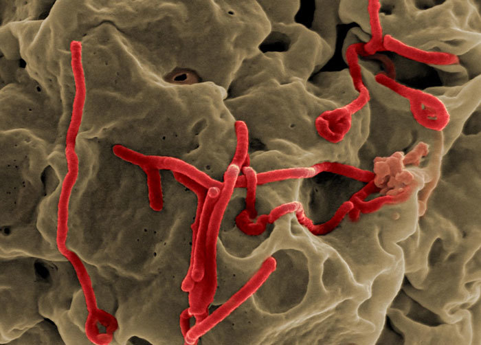 Scanning electron micrograph of Ebola virus budding from the surface of a Vero cell (African green monkey kidney epithelial cell line).