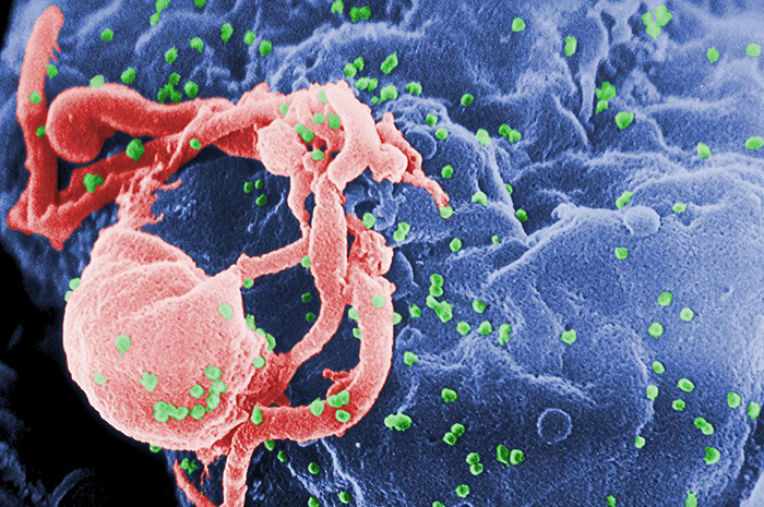 Scanning electron micrograph of HIV-1 budding (in green) from cultured lymphocyte. This image has been coloured to highlight important features. Multiple round bumps on cell surface represent sites of assembly and budding of virions.