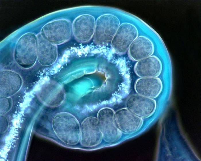 A section of a gravid (pregnant) female Nippostrongylus brasiliensis parasitic nematode.