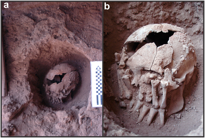 The severed head was found in a pit (a) with hands carefully arranged over the skull (b).