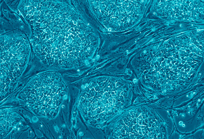 Human embryonic stem cells. (Image by Nissim Benvenisty, accessed via <a href="https://commons.wikimedia.org/wiki/File:Human_embryonic_stem_cells.png" target="">Wikimedia Commons</a>).