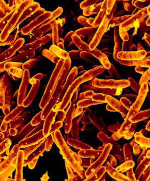 Mycobacterium tuberculosis, the cause of TB.