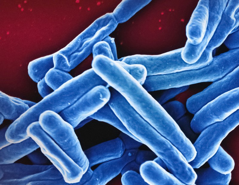 Mycobacterium Tuberculosis Bacteria Scanning electron micrograph of Mycobacterium tuberculosis particles (colourised blue), the bacterium which causes TB. Credit: NIAID