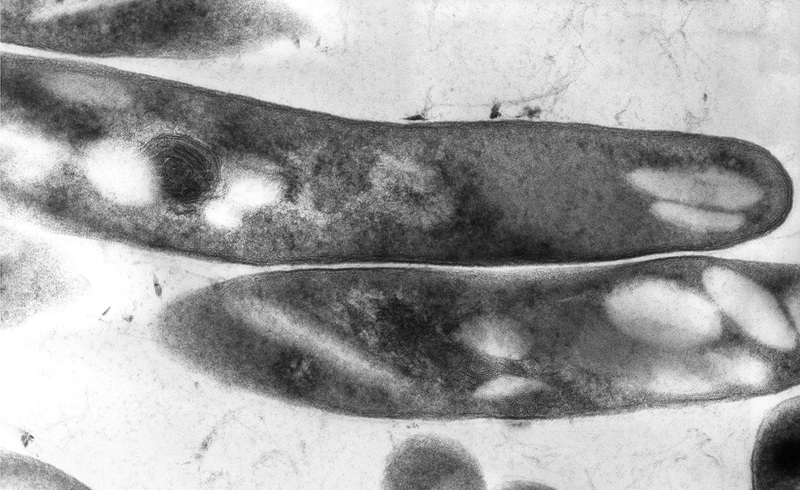 Mycobacterium tuberculosis, the bacterium that leads to the Tuberculosis disease. Photo Centers for Disease Control and Prevention. 