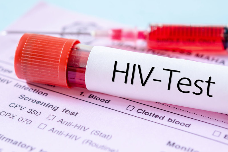 South Africa has reason to celebrate the drop in AIDS-related deaths, said Prof Linda-Gail Bekker.