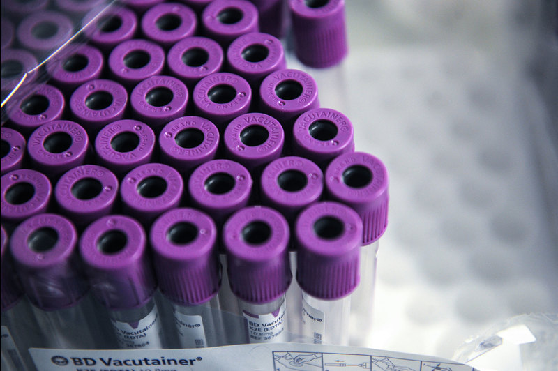 UCTLI will continue to assess BTZ-043’s efficacy in combination with Bedaquiline and Delamanid, two other new TB drugs recently registered for use in multidrug resistant TB.