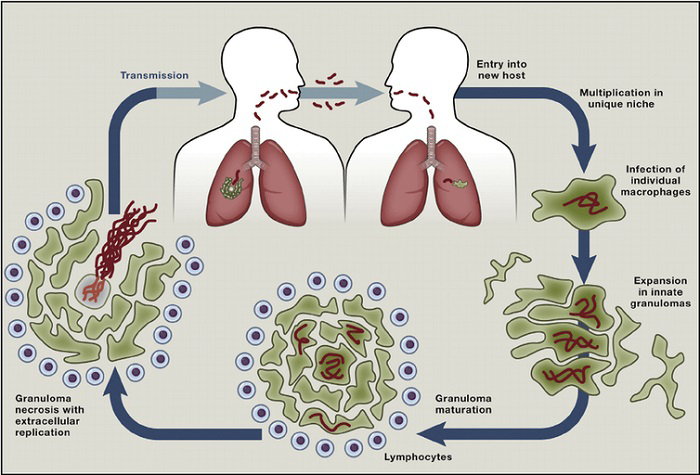 Inflammation