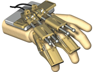 Hand-finger orthosis